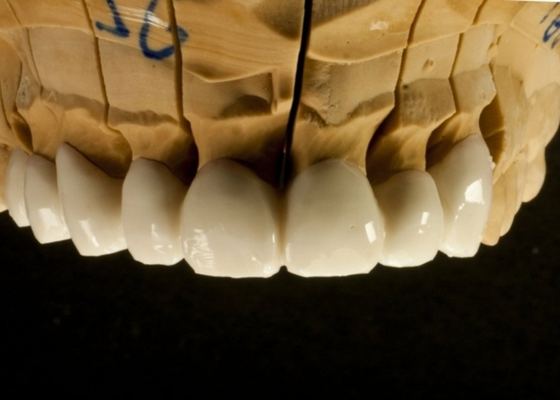Dental