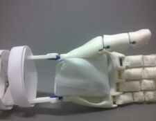 protesis de mano Flexy Hand