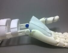 protesis de mano Flexy Hand