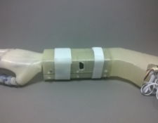 protesis de mano Limbitless Arm